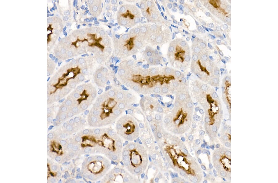 Immunohistochemistry - Anti-ACE2 Antibody [ARC50948] (A308382) - Antibodies.com
