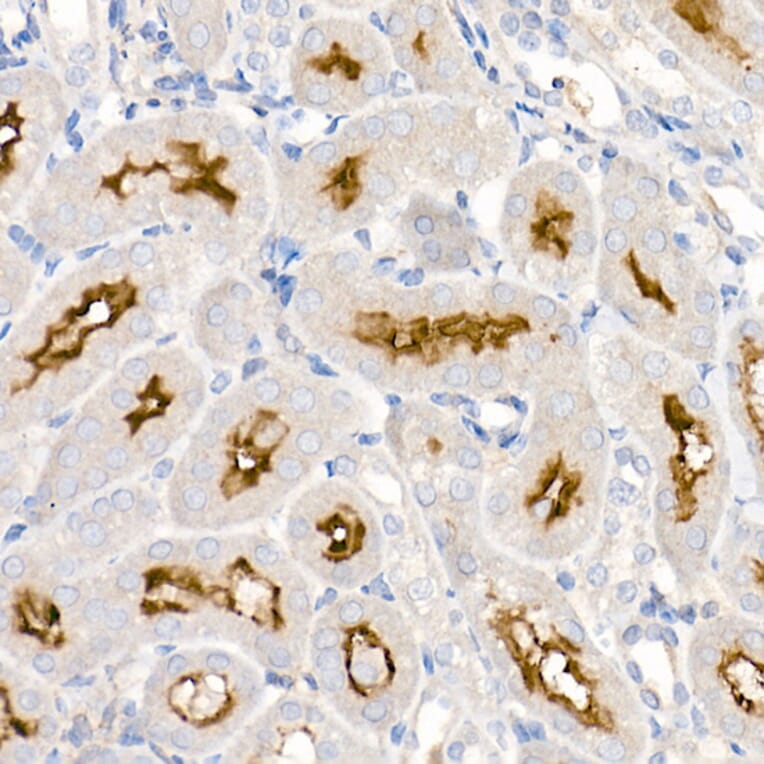 Immunohistochemistry - Anti-ACE2 Antibody [ARC50948] (A308382) - Antibodies.com
