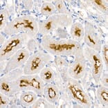 Immunohistochemistry - Anti-ACE2 Antibody [ARC50948] (A308382) - Antibodies.com