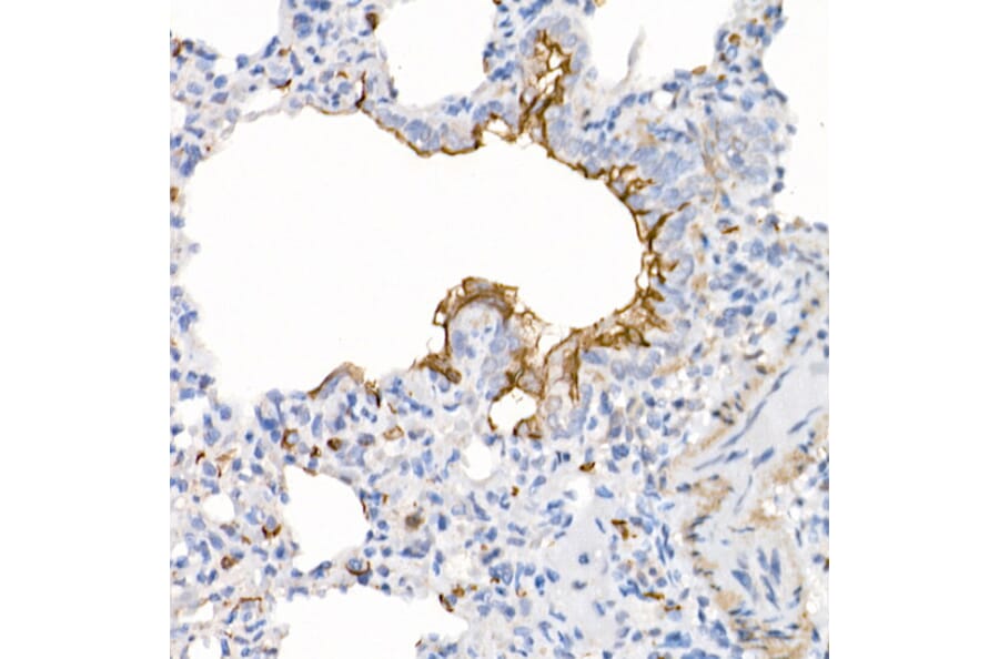 Immunohistochemistry - Anti-ACE2 Antibody [ARC50948] (A308382) - Antibodies.com