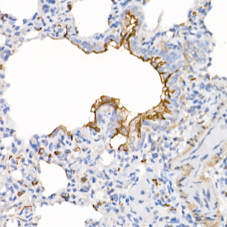 Immunohistochemistry - Anti-ACE2 Antibody [ARC50948] (A308382) - Antibodies.com