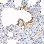 Immunohistochemistry - Anti-ACE2 Antibody [ARC50948] (A308382) - Antibodies.com