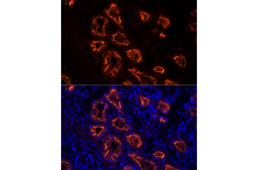 Immunofluorescence - Anti-ACE2 Antibody [ARC50948] (A308382) - Antibodies.com