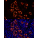 Immunofluorescence - Anti-ACE2 Antibody [ARC50948] (A308382) - Antibodies.com
