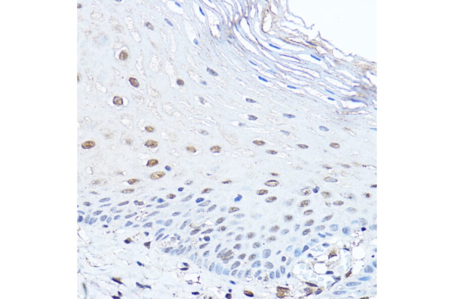 Immunohistochemistry - Anti-PAX3 Antibody (A308383) - Antibodies.com