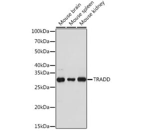 Western Blot - Anti-TRADD Antibody (A308387) - Antibodies.com
