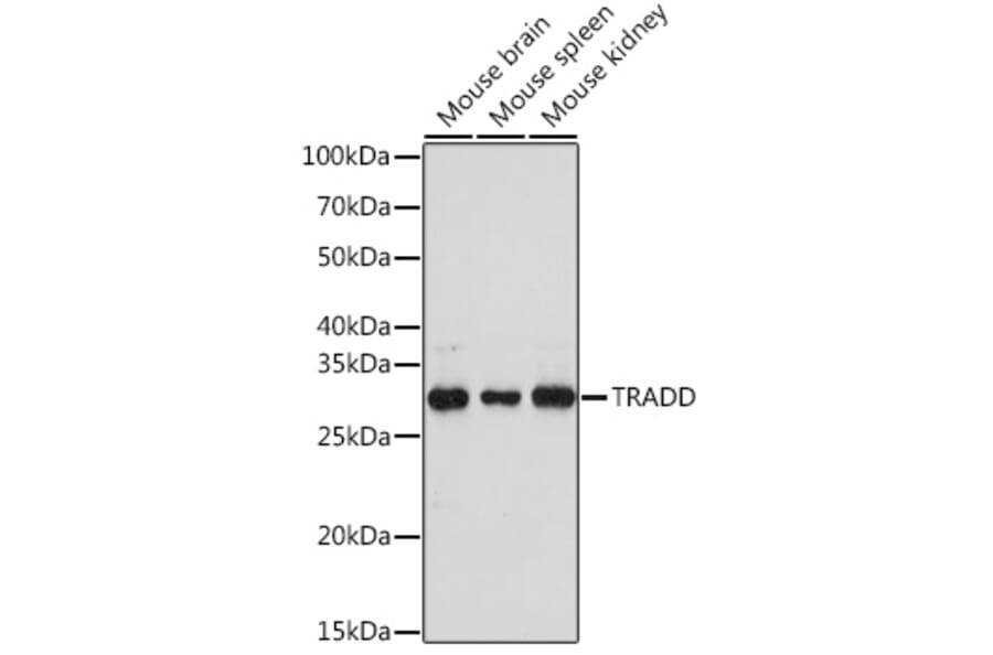 Western Blot - Anti-TRADD Antibody (A308387) - Antibodies.com