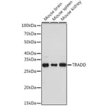 Western Blot - Anti-TRADD Antibody (A308387) - Antibodies.com