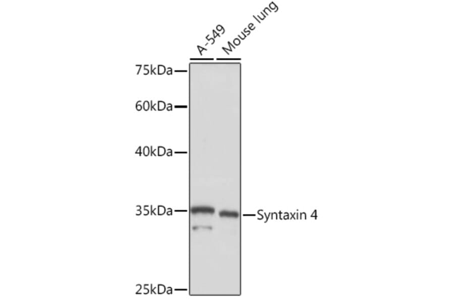 Western Blot - Anti-Syntaxin 4 Antibody [ARC2113] (A308390) - Antibodies.com