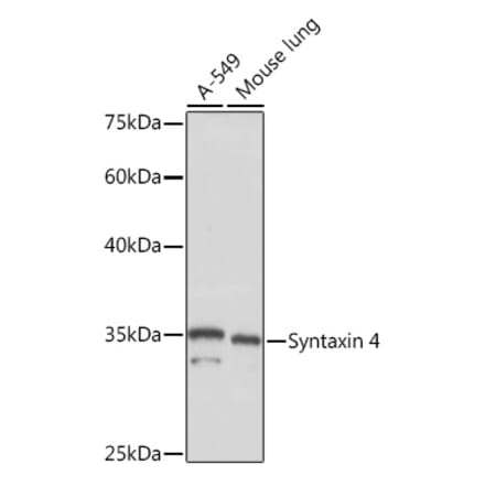 Western Blot - Anti-Syntaxin 4 Antibody [ARC2113] (A308390) - Antibodies.com