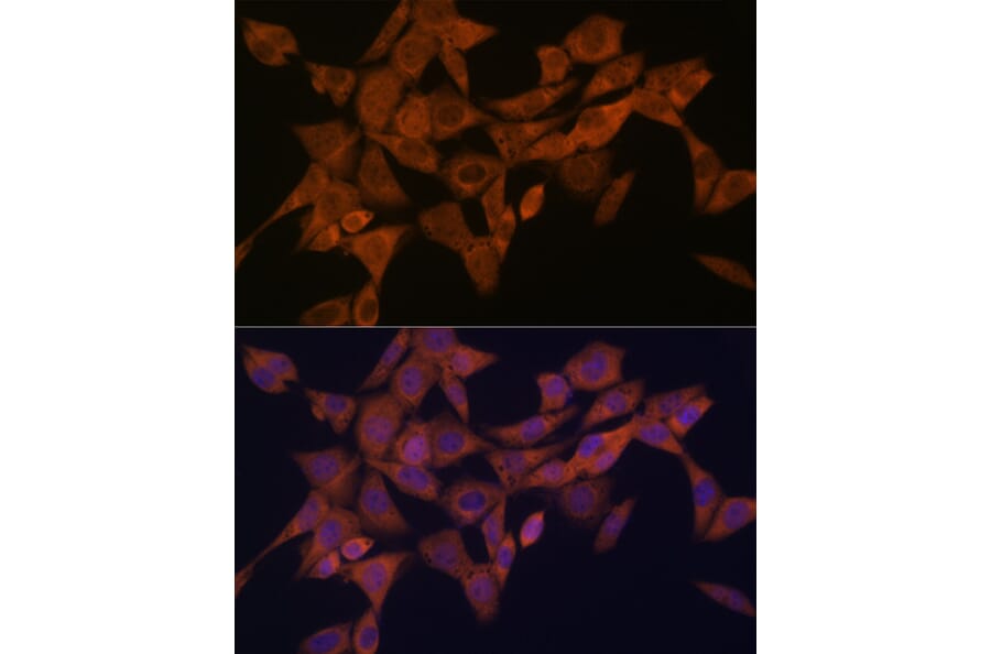Immunofluorescence - Anti-Syntaxin 4 Antibody [ARC2113] (A308390) - Antibodies.com