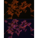 Immunofluorescence - Anti-Syntaxin 4 Antibody [ARC2113] (A308390) - Antibodies.com