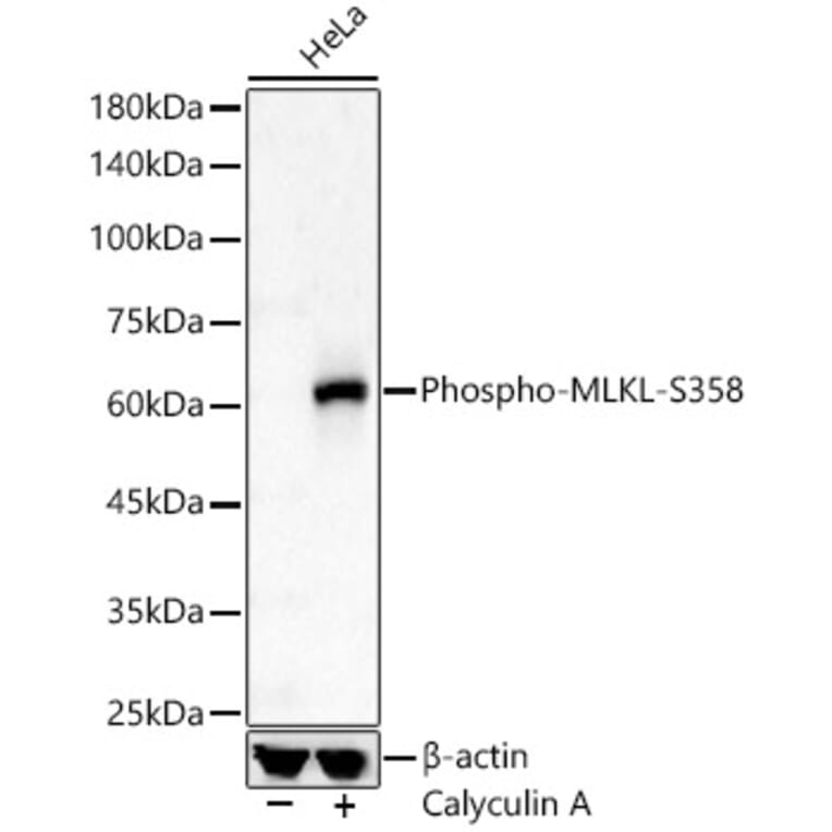 Western Blot - Anti-MLKL (phospho Ser358) Antibody (A308391) - Antibodies.com