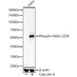 Western Blot - Anti-MLKL (phospho Ser358) Antibody (A308391) - Antibodies.com