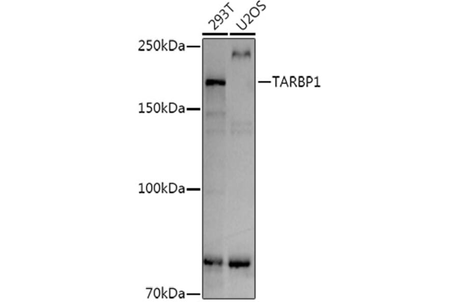 Western Blot - Anti-TARBP1 Antibody (A308393) - Antibodies.com