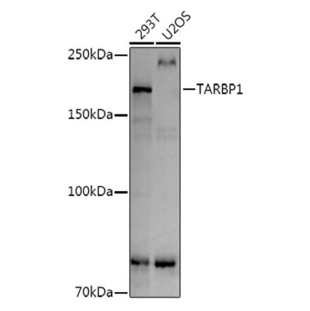 Western Blot - Anti-TARBP1 Antibody (A308393) - Antibodies.com