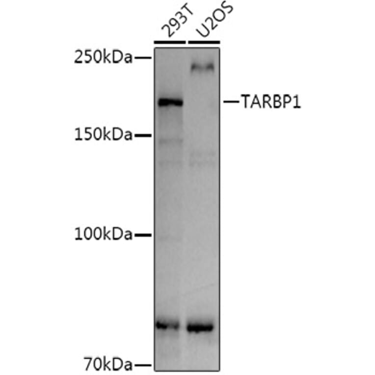 Western Blot - Anti-TARBP1 Antibody (A308393) - Antibodies.com