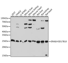 Western Blot - Anti-ERAB Antibody [ARC1852] (A308394) - Antibodies.com