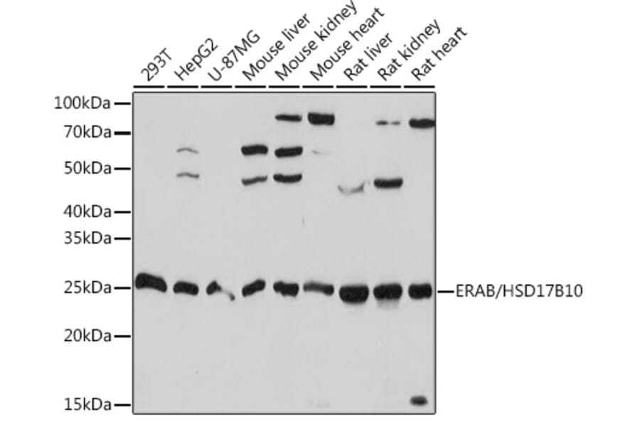 Western Blot - Anti-ERAB Antibody [ARC1852] (A308394) - Antibodies.com