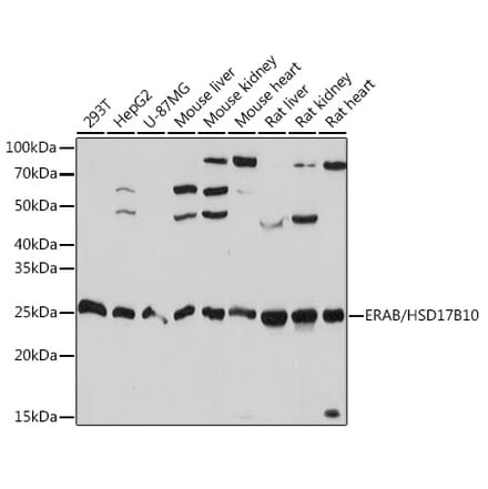 Western Blot - Anti-ERAB Antibody [ARC1852] (A308394) - Antibodies.com