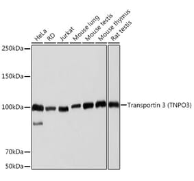 Western Blot - Anti-TNPO3 Antibody [ARC2310] (A308395) - Antibodies.com