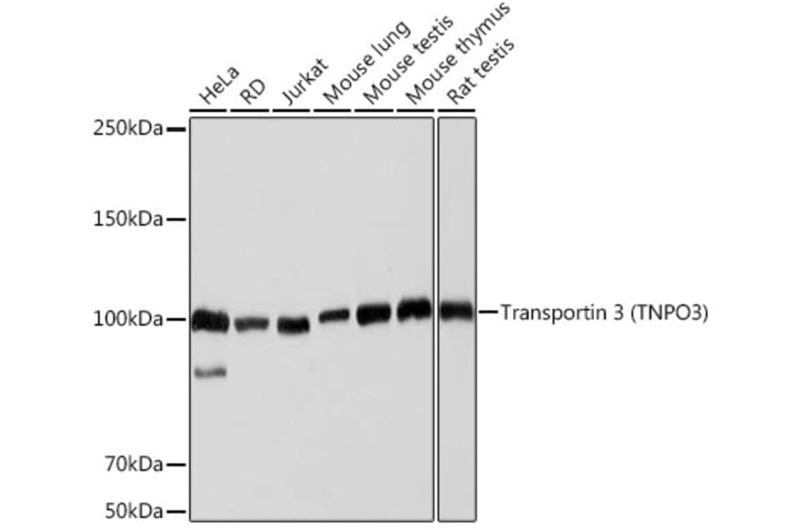 Western Blot - Anti-TNPO3 Antibody [ARC2310] (A308395) - Antibodies.com