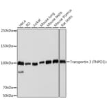 Western Blot - Anti-TNPO3 Antibody [ARC2310] (A308395) - Antibodies.com