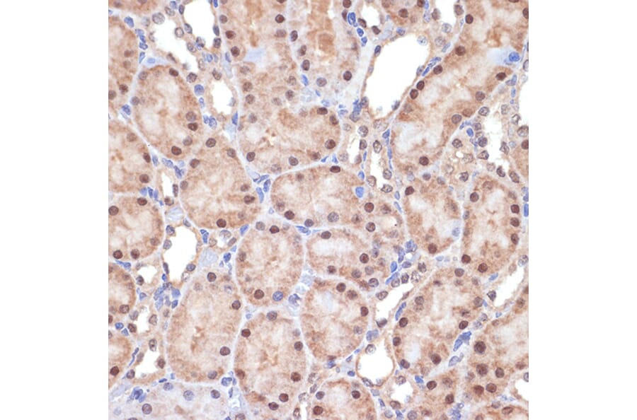 Immunohistochemistry - Anti-TNPO3 Antibody [ARC2310] (A308395) - Antibodies.com