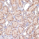 Immunohistochemistry - Anti-TNPO3 Antibody [ARC2310] (A308395) - Antibodies.com