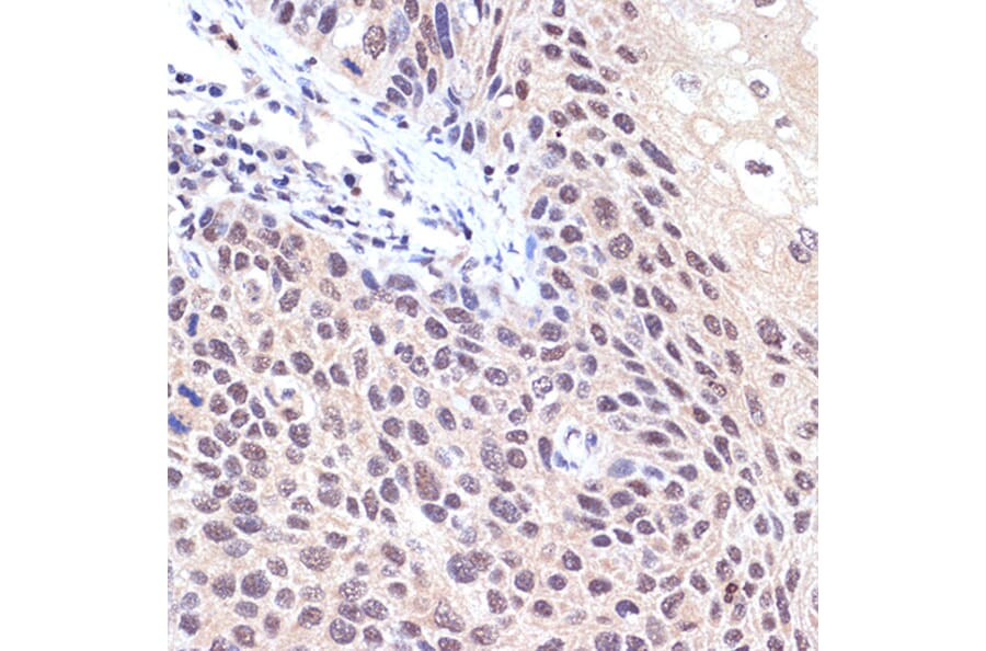 Immunohistochemistry - Anti-TNPO3 Antibody [ARC2310] (A308395) - Antibodies.com