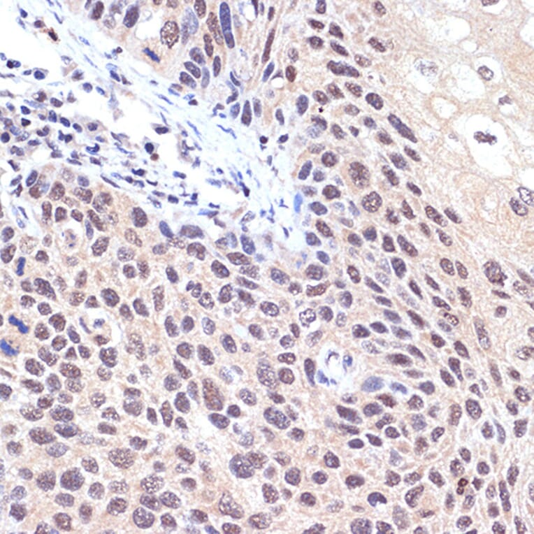 Immunohistochemistry - Anti-TNPO3 Antibody [ARC2310] (A308395) - Antibodies.com