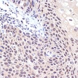 Immunohistochemistry - Anti-TNPO3 Antibody [ARC2310] (A308395) - Antibodies.com