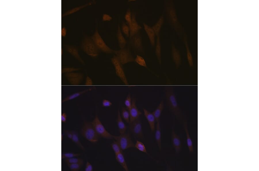 Immunofluorescence - Anti-TNPO3 Antibody [ARC2310] (A308395) - Antibodies.com