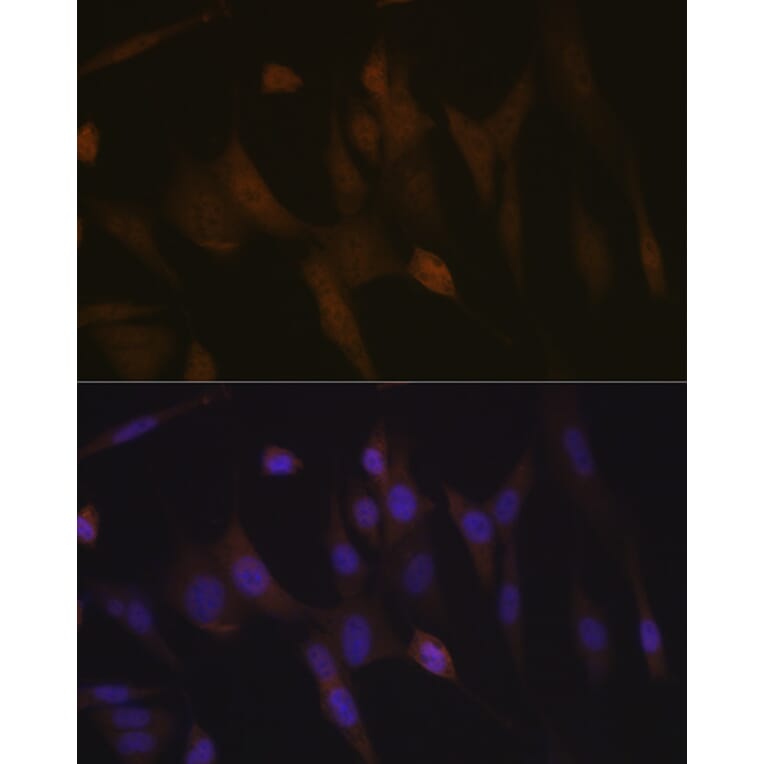 Immunofluorescence - Anti-TNPO3 Antibody [ARC2310] (A308395) - Antibodies.com