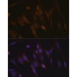 Immunofluorescence - Anti-TNPO3 Antibody [ARC2310] (A308395) - Antibodies.com