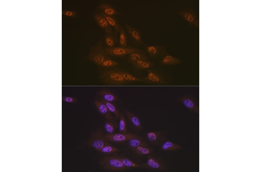 Immunofluorescence - Anti-TNPO3 Antibody [ARC2310] (A308395) - Antibodies.com