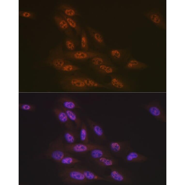 Immunofluorescence - Anti-TNPO3 Antibody [ARC2310] (A308395) - Antibodies.com