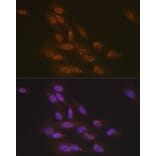 Immunofluorescence - Anti-TNPO3 Antibody [ARC2310] (A308395) - Antibodies.com