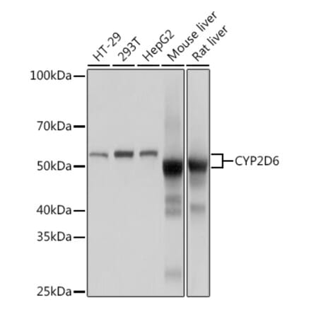 Western Blot - Anti-CYP2D6 Antibody [ARC1635] (A308397) - Antibodies.com