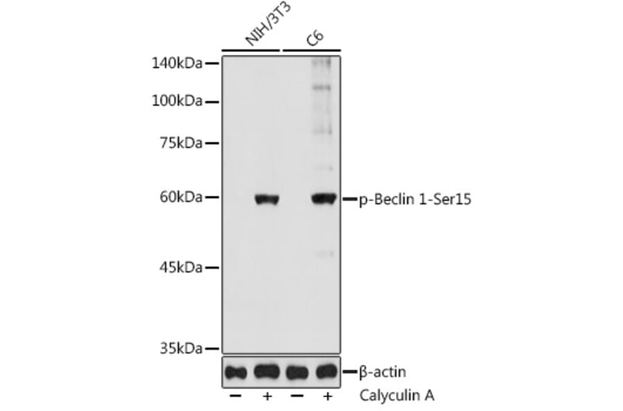 Western Blot - Anti-Beclin 1 (phospho Ser15) Antibody (A308398) - Antibodies.com