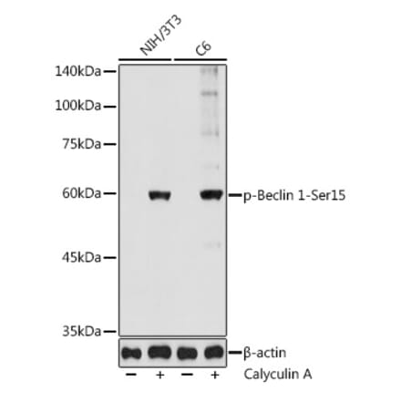 Western Blot - Anti-Beclin 1 (phospho Ser15) Antibody (A308398) - Antibodies.com