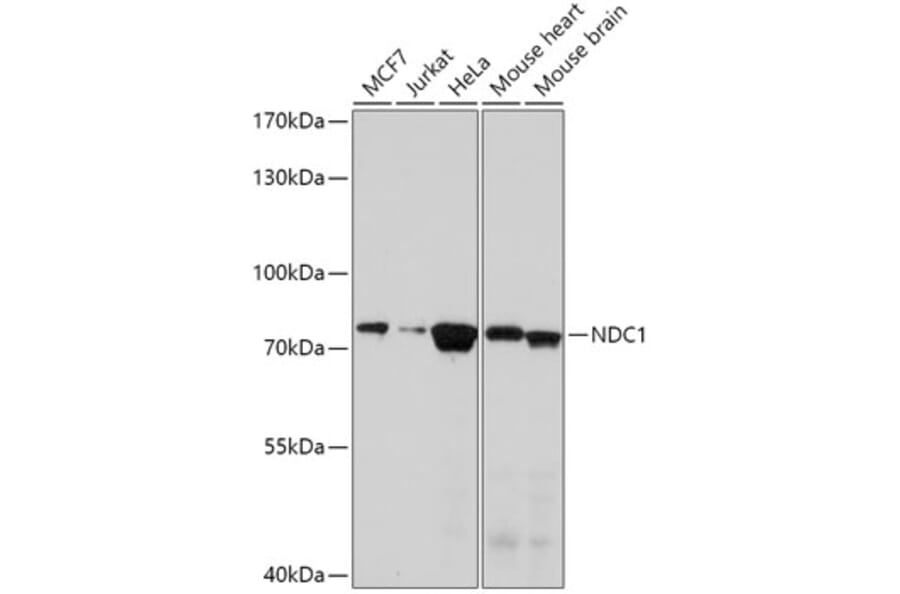 Western Blot - Anti-NDC1 Antibody (A308402) - Antibodies.com