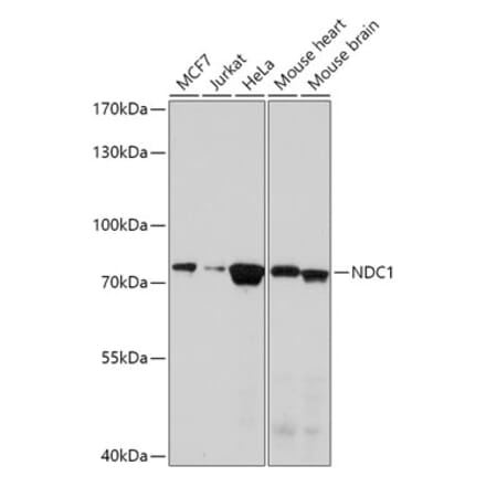 Western Blot - Anti-NDC1 Antibody (A308402) - Antibodies.com