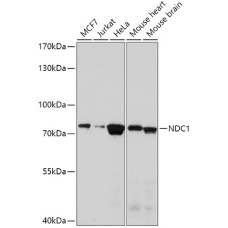 Western Blot - Anti-NDC1 Antibody (A308402) - Antibodies.com