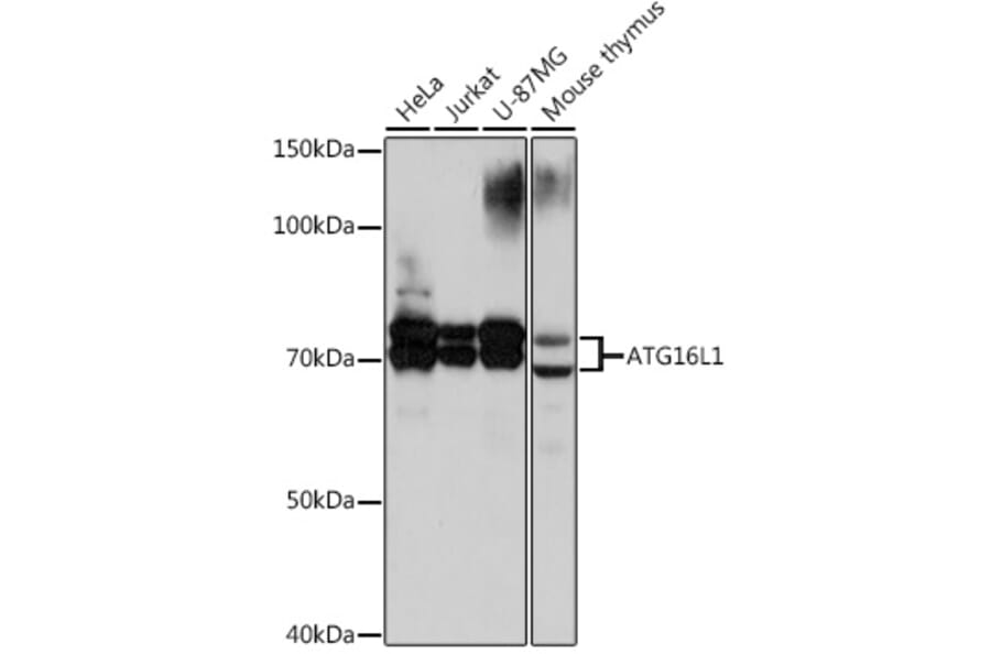 Western Blot - Anti-ATG16L1 Antibody [ARC0812] (A308403) - Antibodies.com