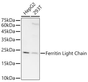 Western Blot - Anti-Ferritin Light Chain Antibody [ARC57605] (A308404) - Antibodies.com