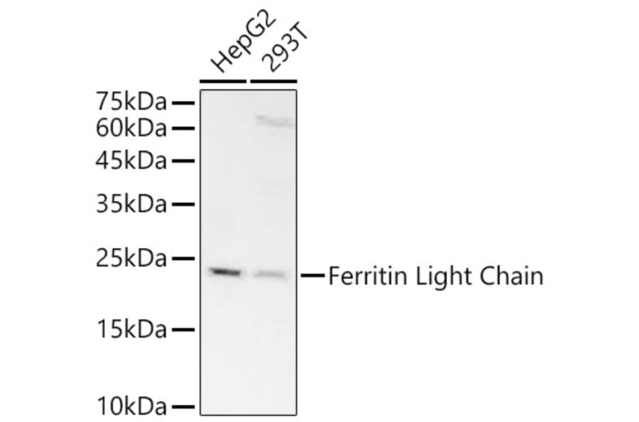 Western Blot - Anti-Ferritin Light Chain Antibody [ARC57605] (A308404) - Antibodies.com