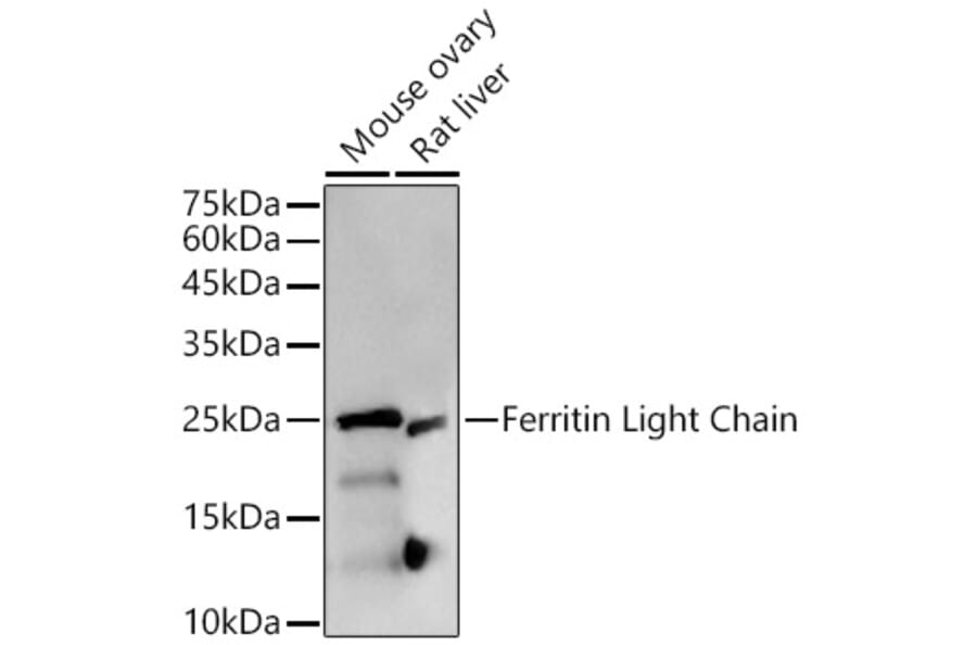 Western Blot - Anti-Ferritin Light Chain Antibody [ARC57605] (A308404) - Antibodies.com