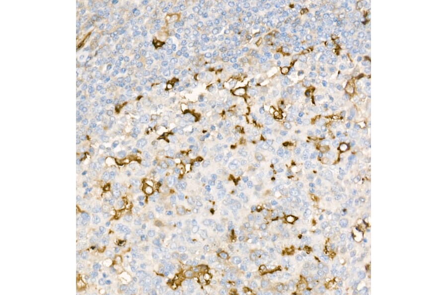 Immunohistochemistry - Anti-Ferritin Light Chain Antibody [ARC57605] (A308404) - Antibodies.com