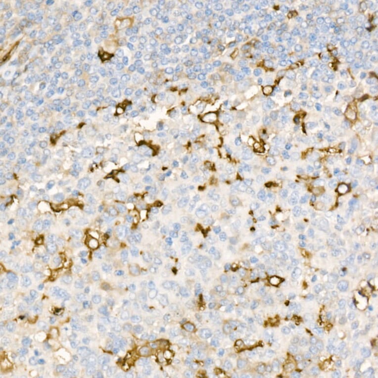 Immunohistochemistry - Anti-Ferritin Light Chain Antibody [ARC57605] (A308404) - Antibodies.com